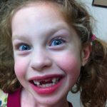 Sam the Anti-Preemie's sister loose three teeth