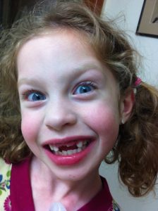 Sam the Anti-Preemie's sister loose three teeth