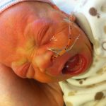 Sam the Anti-Preemie: Soundless scream in NICU | 11/19/2010